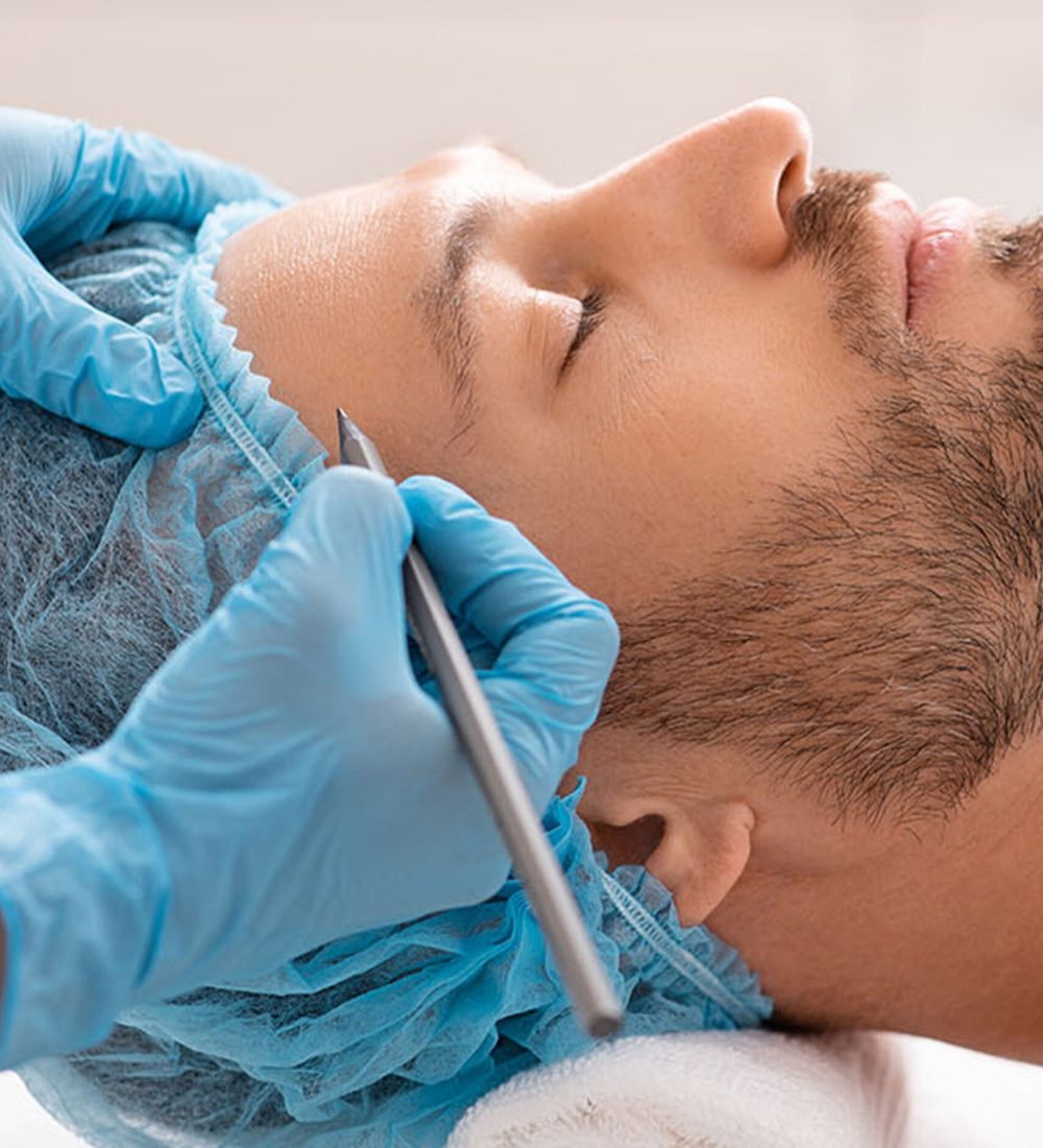 close-up plastic surgeon makes marks on a patient's face during a consultation before nose operation
